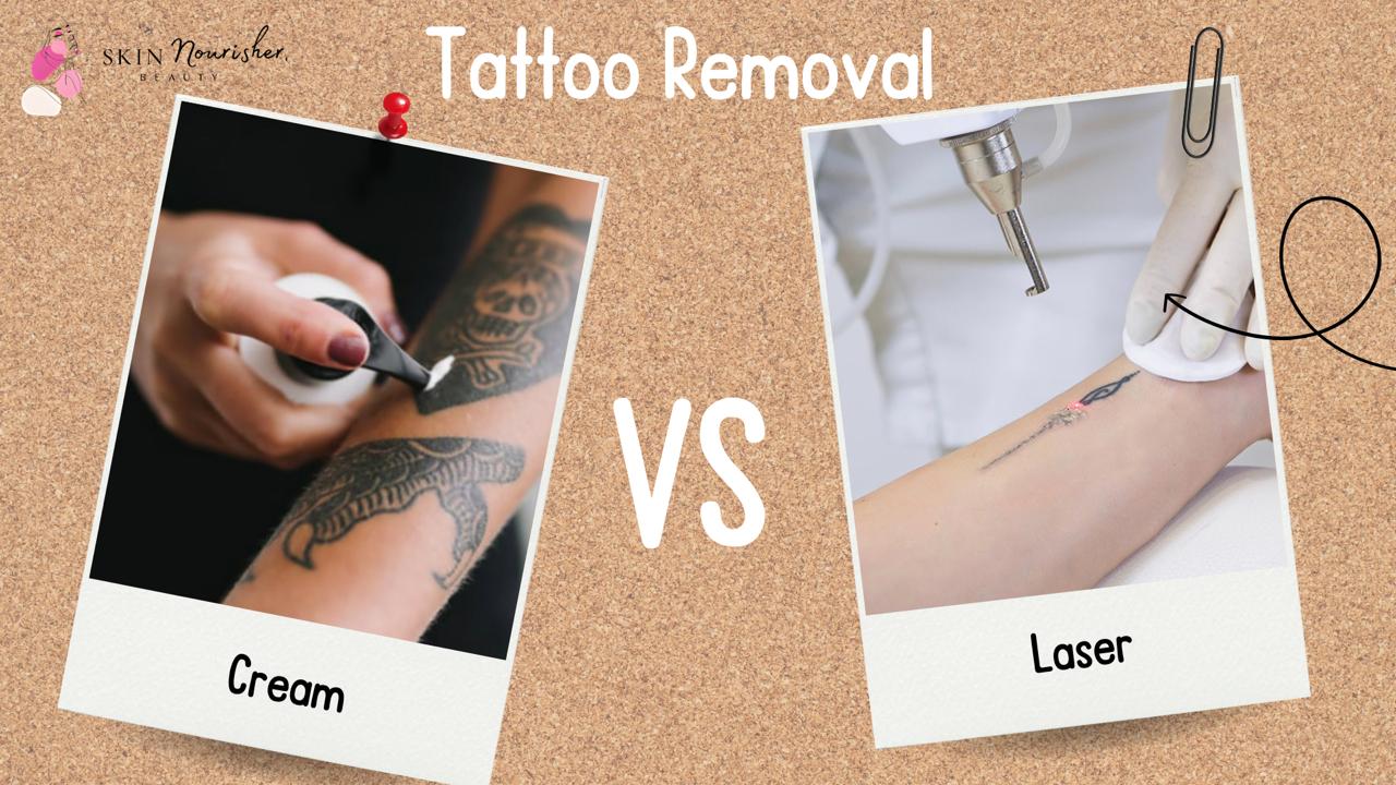 New Tattoo Removal Technology 2024